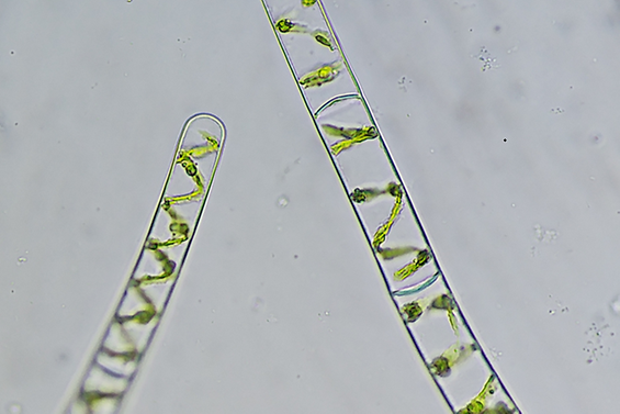 Fadenalge Spirogyra unter dem Mikroskop